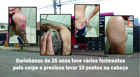 Crime de ódio: Rapaz é agredido após dizer que era Lulista e Petista
