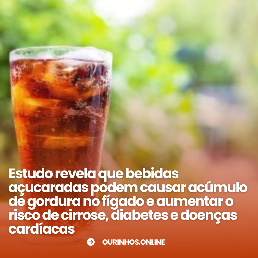 Estudo revela que bebidas açucaradas podem aumentar gordura no fígado e causar sérios riscos à saúde